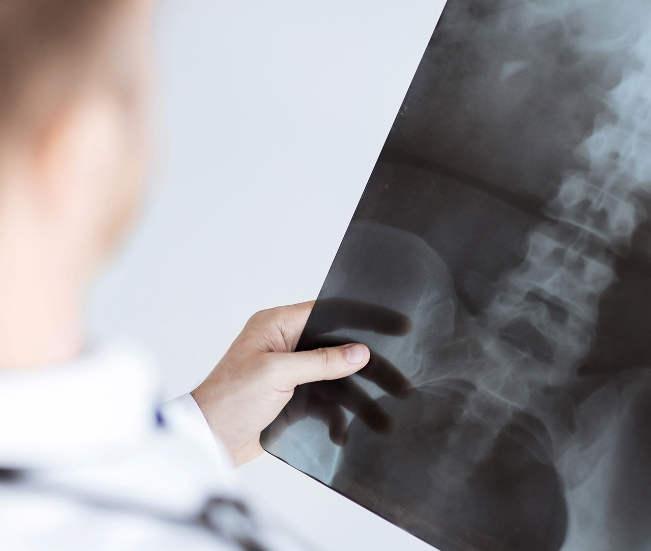 X-Ray scan, health, doctor